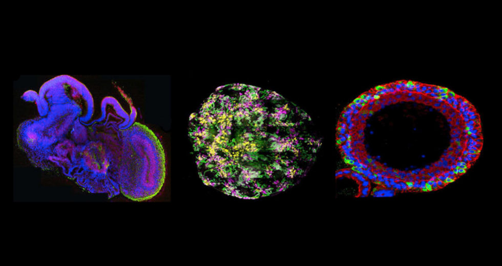 Organoids Or Mini-Organs Are The Latest Groundbreaking Discovery In Analyzing New Drugs And Treatments