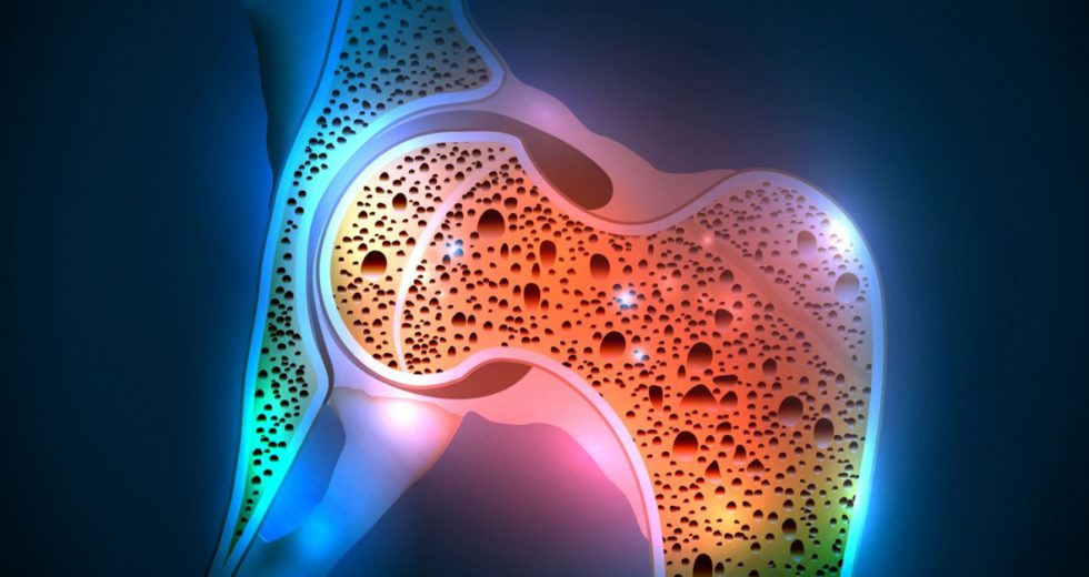 Osteoporosis Is Linked To The Intestinal Microbiota – Probiotics Might Help!
