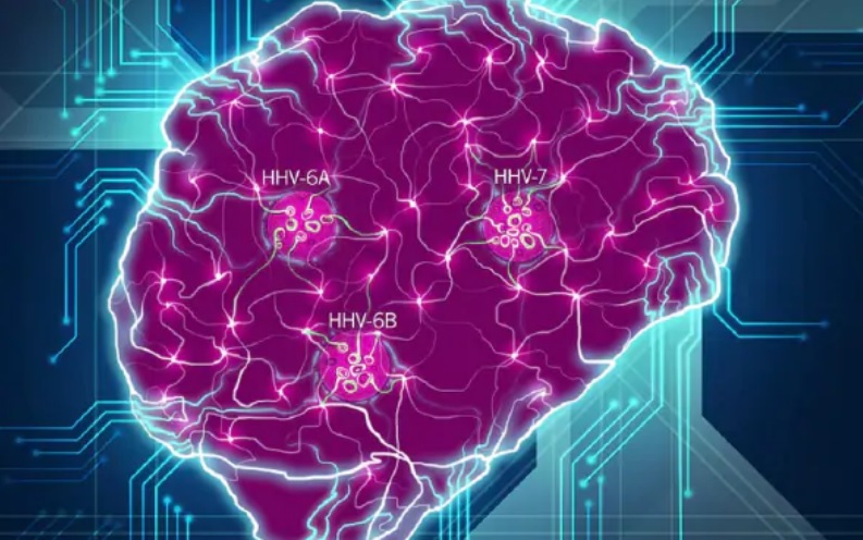 Alzheimer’s Disease Might Have A Viral Origin, And The Culprit Would Be The Herpesvirus