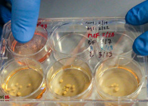 Neanderthal Mini-Brains Possess Characteristics Seen In Modern Humans With Autism