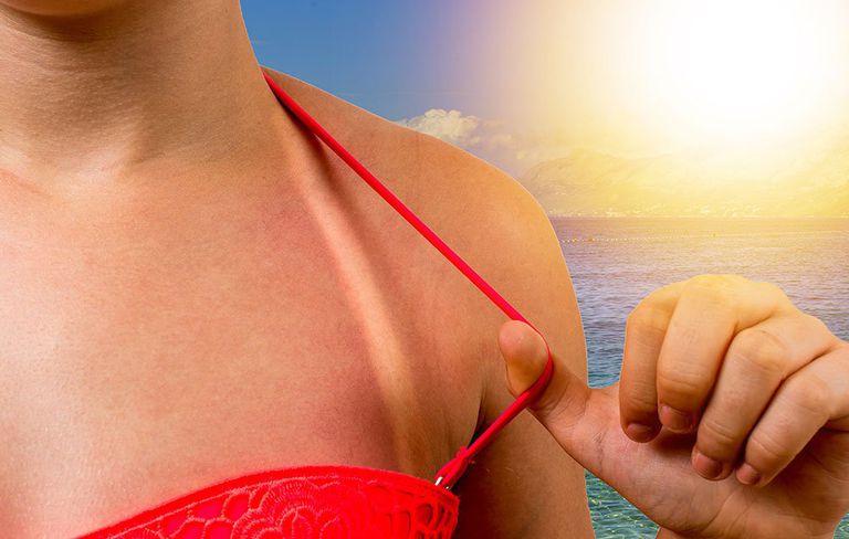 Shaving Foam Is A Surprising Remedy To Relieve Sunburn Symptoms