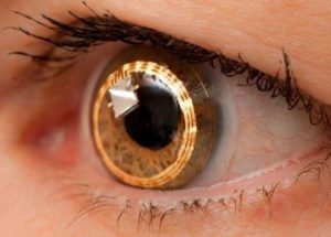 New Generation Of Artificial Retina Developed By Scientists, And Is Based On 2D Materials