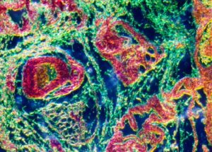New “Micro-Organ” In The Human Immune System Discovered By Scientists