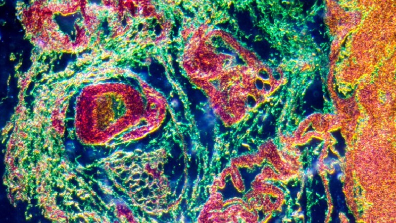 New “Micro-Organ” In The Human Immune System Discovered By Scientists