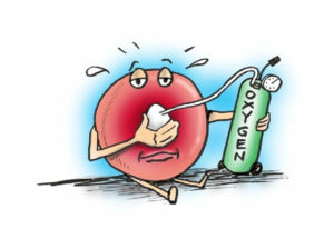 Oxygen Therapy Doesn’t Prevent Heart Failure In Heart Attack Patients