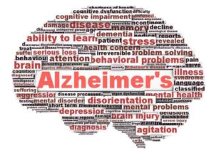 Alzheimer’s Disease Related To Heavily Sleeping During The Day