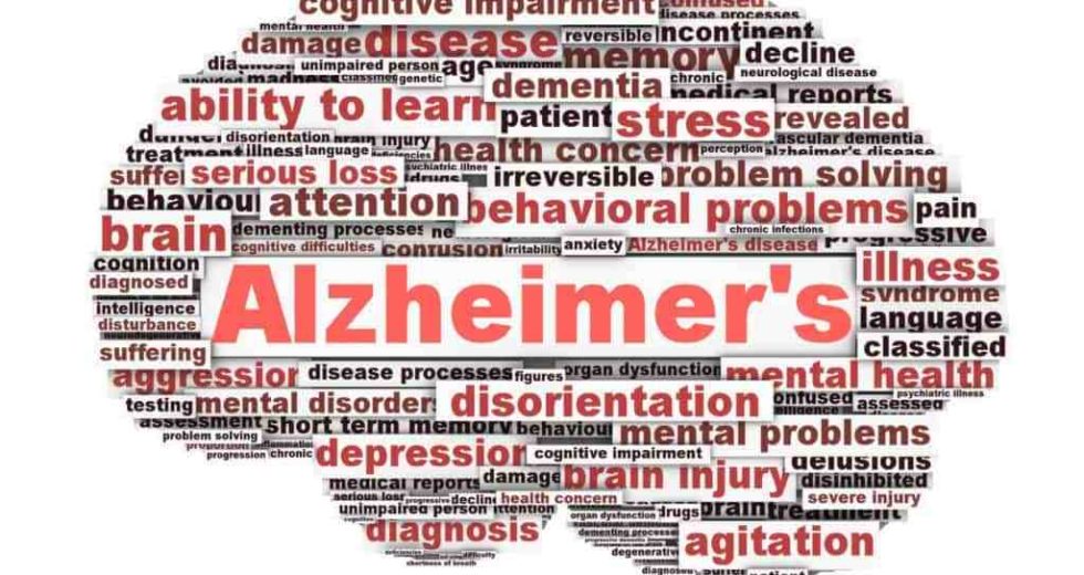 Alzheimer’s Disease Related To Heavily Sleeping During The Day