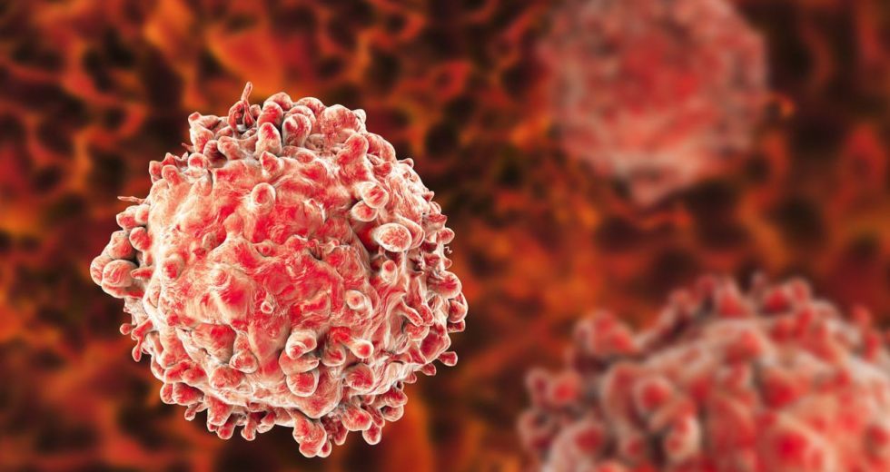 Chemotherapy Is Involved In Acute Myeloid Leukemia Cancer Relapse