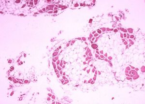 CRISPR Gene-Editing Halted Muscular Dystrophy In Dogs, Rising Hopes in Humans