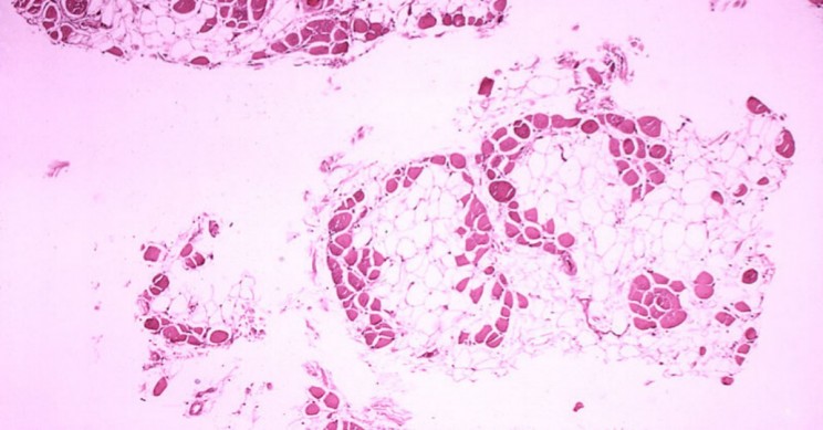 CRISPR Gene-Editing Halted Muscular Dystrophy In Dogs, Rising Hopes in Humans