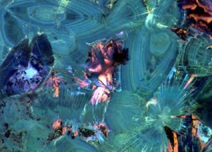 Kidney Stones Possess Different Geological Histories, A New Research Disclosed