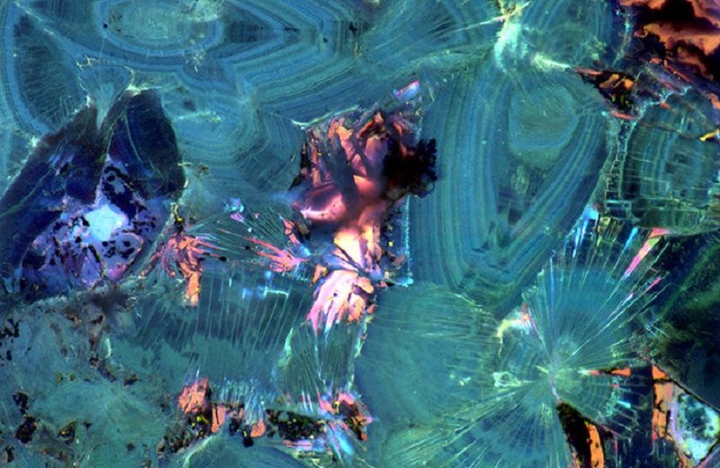 Kidney Stones Possess Different Geological Histories, A New Research Disclosed