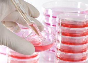 A Mitochondrial Peptide, “Humanin,” Can Protect Against Dementia’s Disease