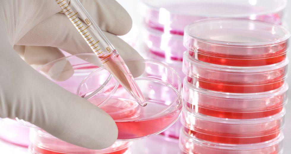 A Mitochondrial Peptide, “Humanin,” Can Protect Against Dementia’s Disease