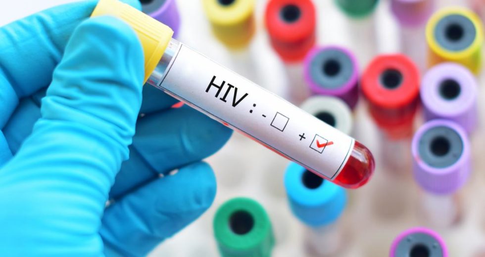 New Immunotherapy Against HIV, Developed By Researchers At The Rockefeller University