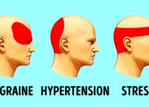 Best Pressure Points To Get Rid of Headaches Immediately