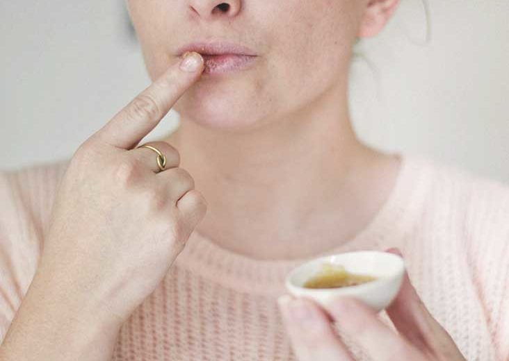 Canker Sores Can be Cured with Essential Oils