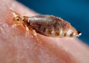 Typhus Epidemic Reached Los Angeles, USA