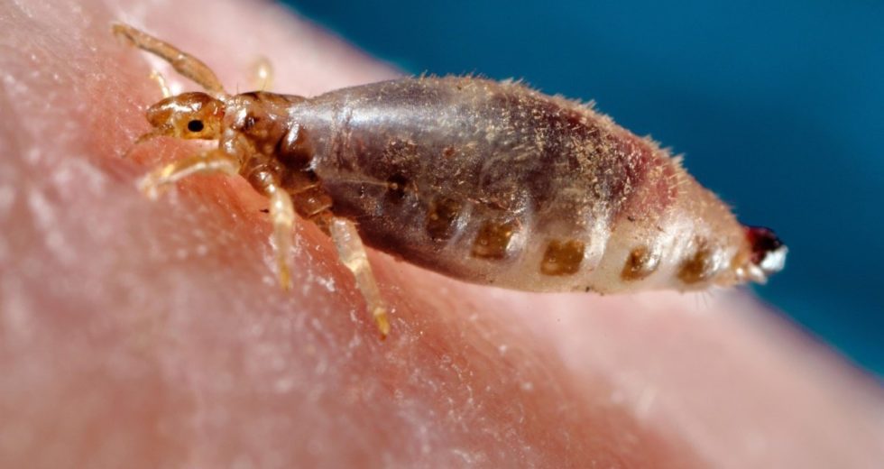Typhus Epidemic Reached Los Angeles, USA