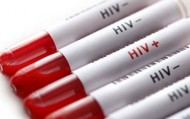 UNAIDS Report Says That 9.4 Million People Are Infected With HIV, But They Don’t Know