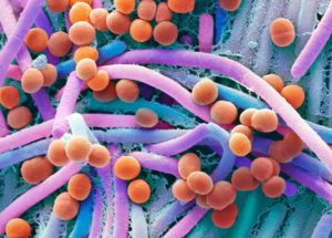 Gut Bacteria Alterations Linked To Diabetes, HIV, Multiple Sclerosis, Cardiovascular Conditions, Among Others