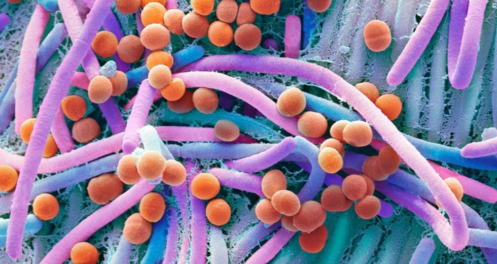 Gut Bacteria Alterations Linked To Diabetes, HIV, Multiple Sclerosis, Cardiovascular Conditions, Among Others
