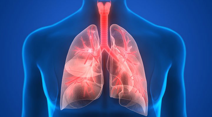 Pneumonia Kills About 1 Million Children Under The Age of 5, Annually