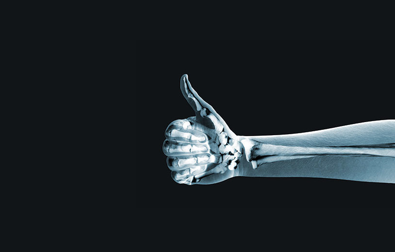 Probiotics Enhance The Bone Health In Healthy Mice, A New Study Says