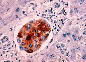 A 10-minute Test Could Show if There are any Cancer Cells in the Human Body