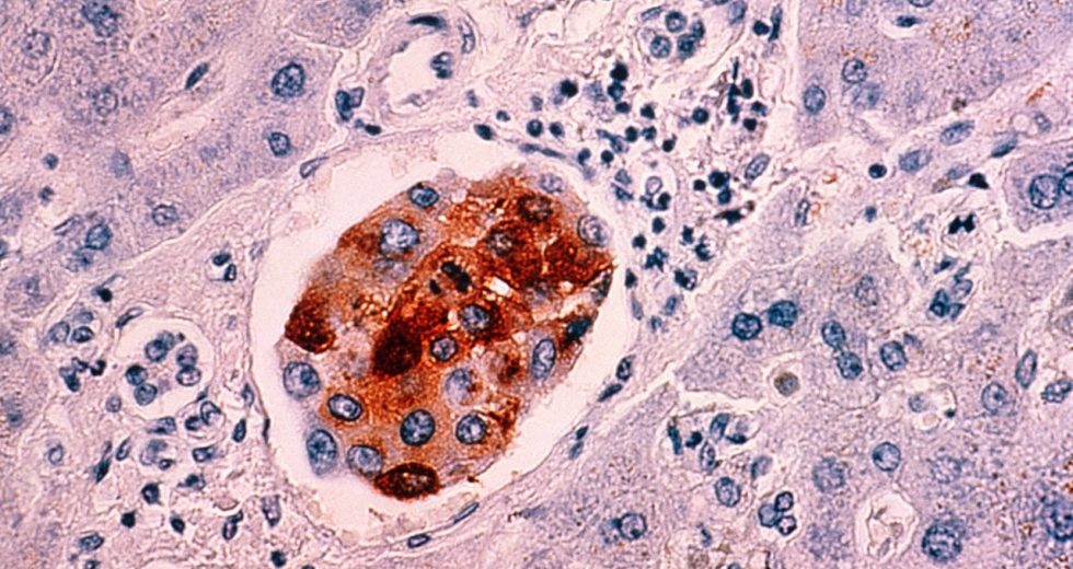 A 10-minute Test Could Show if There are any Cancer Cells in the Human Body