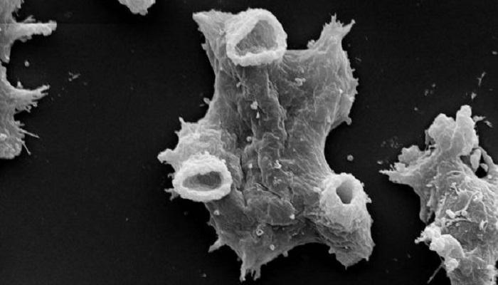 Brain-Eating Amoeba Found In A Seattle Woman