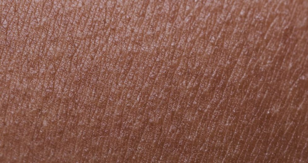 Top 10 Skin Disorders and How to Prevent Them