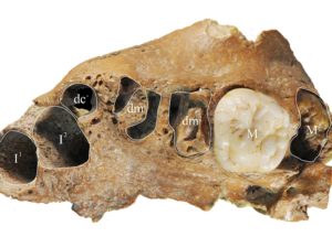 Ancient Human Found in China Presents Modern Dental Growth