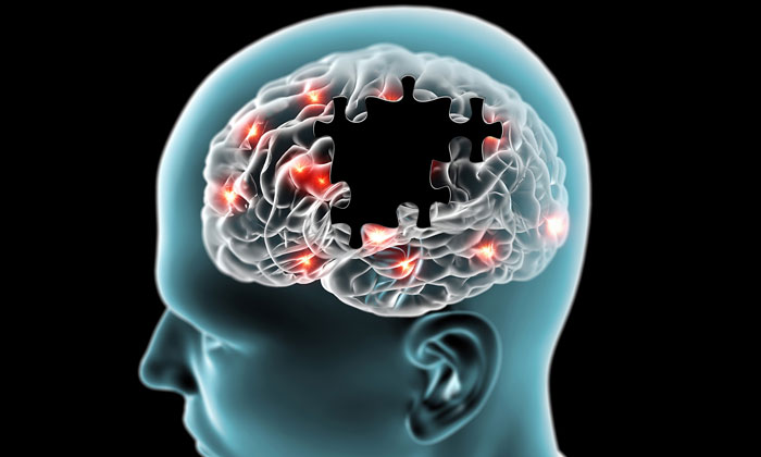 Drinkable Cocktail Of Designer Molecules Shows Promise In Alzheimer’s Disease Treatment