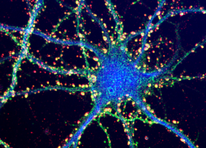Scientists Shed More Light On The Brain Evolution In Humans