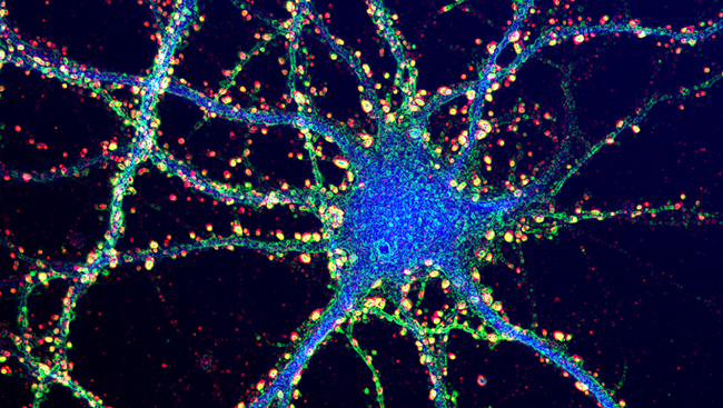 Scientists Shed More Light On The Brain Evolution In Humans