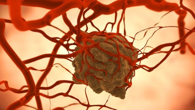 Improved Cancer Therapy Is Currently Under Development, Based On Theranostics