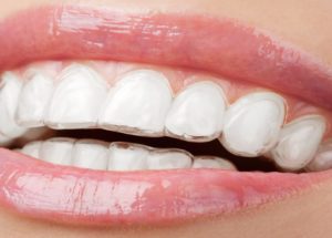Whitening Strips Could Damage Teeth, New Report Showed