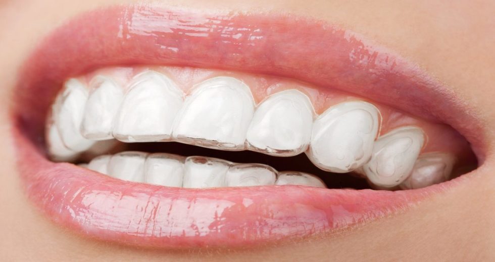 Whitening Strips Could Damage Teeth, New Report Showed