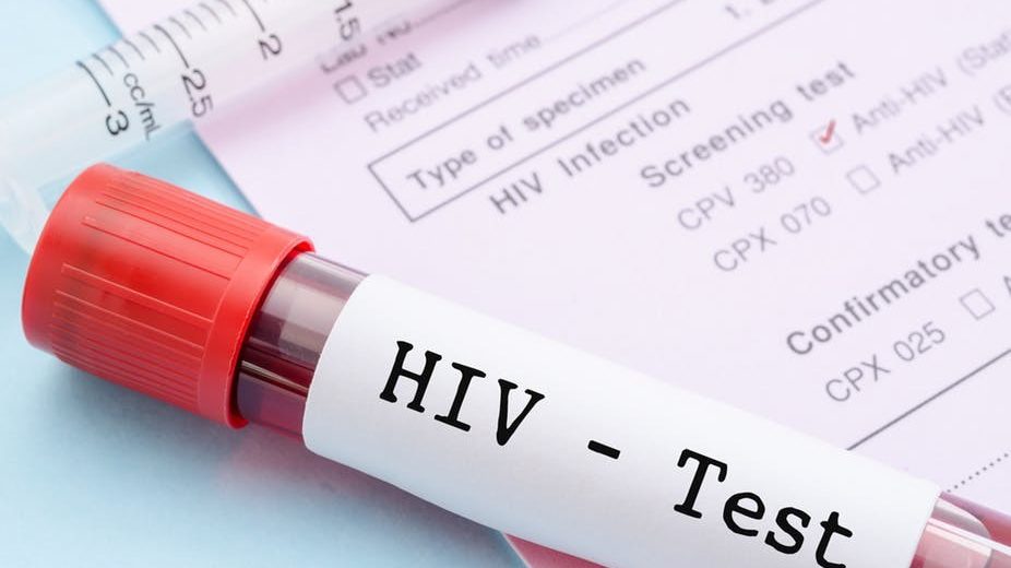 Scientists Discovered A Better Strategy To Fight HIV