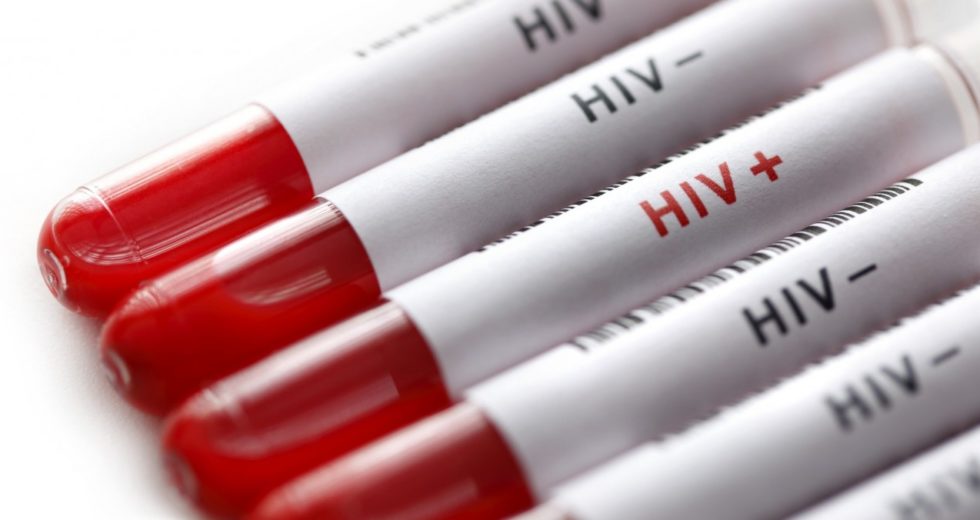 New Studies Are Showing a Method of Preventing HIV Transmission