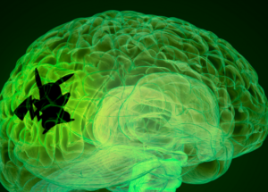 Playing Pokemon Games As A Kid Might Activate Some Special Brain Regions