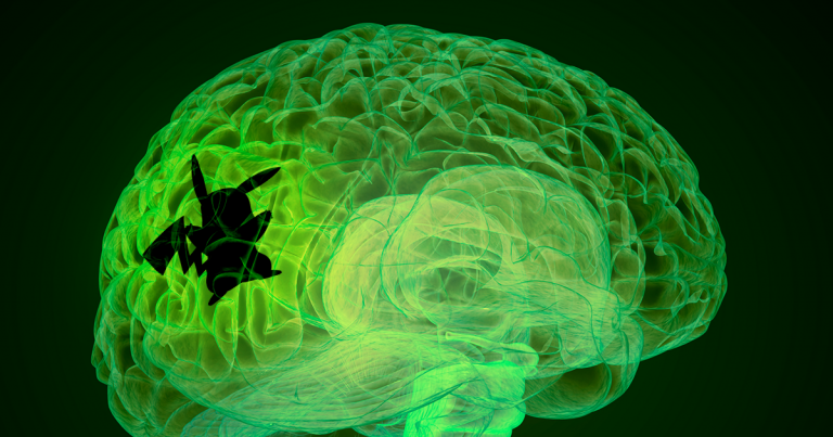 Playing Pokemon Games As A Kid Might Activate Some Special Brain Regions