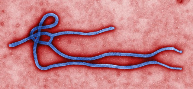 Ebola is no longer incurable, two new efficient drugs have been tested and the results are looking good