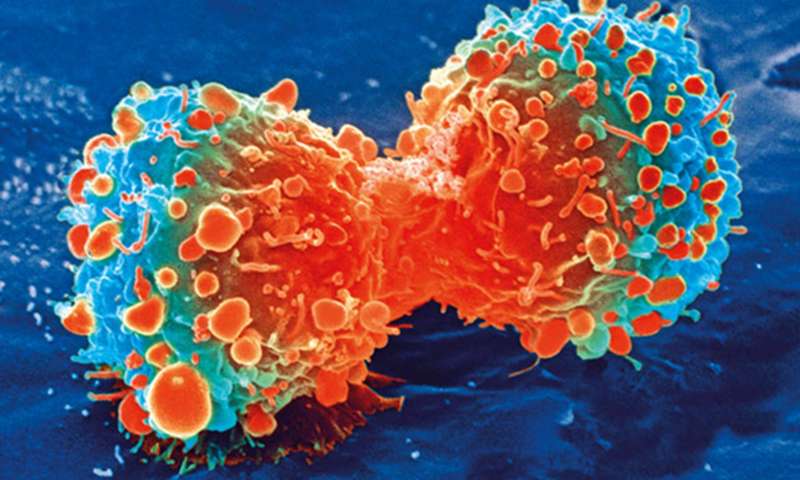 High Stress can Increase Mortality Rates Among Patients Diagnosed with Cervical Cancer