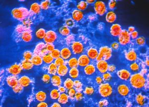 L.A. Health Officials Issue List of Possible Locations People Might Have Been Exposed to Measles