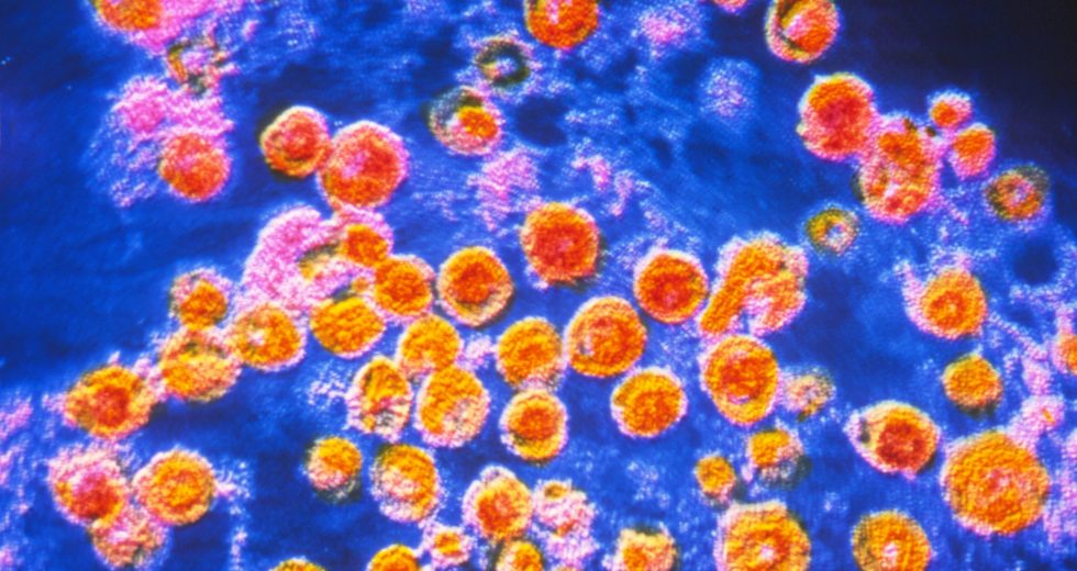 L.A. Health Officials Issue List of Possible Locations People Might Have Been Exposed to Measles