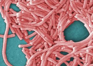 Legionnaires’ disease infects dosins in Atlanta