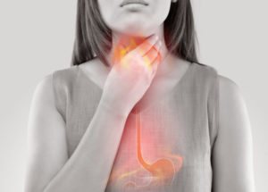 Acid Reflux Linked To Intermittent Fasting And Keto Weight Loss Diets