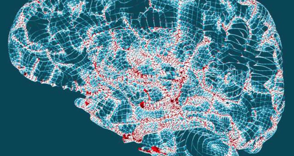 Drowsy Behavior During The Day Might Indicate A Risk Of Alzheimer’s Disease